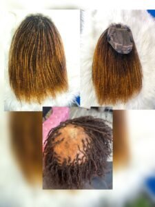 Hairline toupee for aloepecia and cancer patients