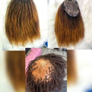 Hairline toupee for alopecia and cancer patients